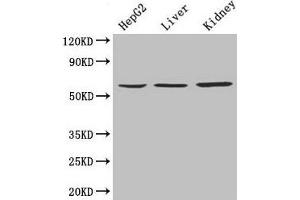 Western Blot Positive WB detected in: HepG2 whole cell lysate, Mouse liver tissue, Mouse kidney tissue All lanes: NAPRT antibody at 4 μg/mL Secondary Goat polyclonal to rabbit IgG at 1/10000 dilution Predicted band size: 58, 61, 57 kDa Observed band size: 58 kDa