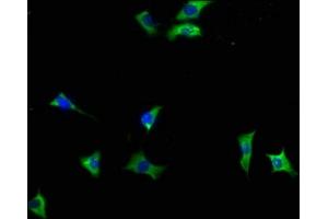 Immunofluorescence staining of SH-SY5Y cells with ABIN7140040 at 1:133, counter-stained with DAPI. (INPP5F Antikörper  (AA 187-204))