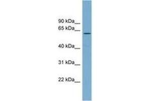 Image no. 1 for anti-RIO Kinase 2 (RIOK2) (AA 179-228) antibody (ABIN6745139) (RIOK2 Antikörper  (AA 179-228))