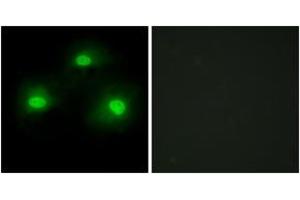 Immunofluorescence analysis of HeLa cells, using IPKA Antibody. (PKIA Antikörper  (AA 10-59))