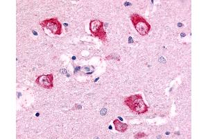 Anti-PAK7 antibody IHC of human brain, thalamus neurons. (PAK7 Antikörper  (Internal Region))
