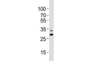 Western blot analysis of lysate from A431 cell line using PHB antibody diluted at 1:1000. (Prohibitin Antikörper  (N-Term))
