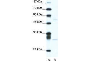 WB Suggested Anti-ATF4 Antibody Titration:  5. (ATF4 Antikörper  (C-Term))