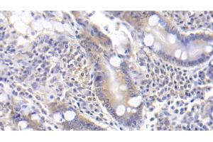 Detection of TFPI in Human Small intestine Tissue using Polyclonal Antibody to Tissue Factor Pathway Inhibitor (TFPI) (TFPI Antikörper  (AA 29-210))