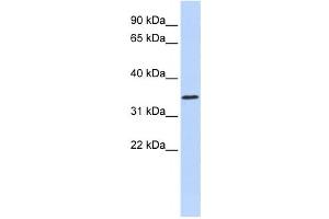 Western Blotting (WB) image for anti-Zinc Finger Protein 660 (ZNF660) antibody (ABIN2458227) (ZNF660 Antikörper)