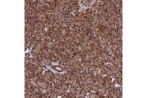Immunohistochemical staining of human pancreas with C14orf166 polyclonal antibody  shows strong nuclear and cytoplasmic positivity in exocrine glandular cells at 1:200-1:500 dilution. (C14orf166 Antikörper)