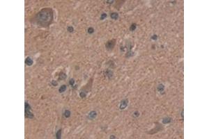 IHC-P analysis of Human Tissue, with DAB staining. (BCL11A Antikörper  (AA 1-210))