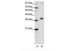 ZNF25 Antikörper  (C-Term)