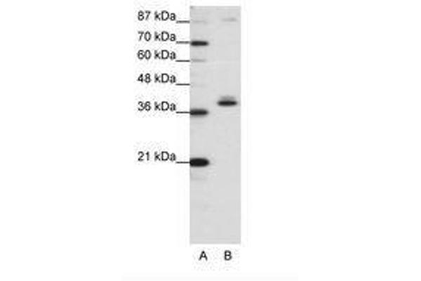 ZNF25 antibody  (C-Term)