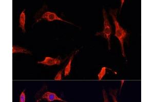 Immunofluorescence analysis of C6 cells using DNASE1 Polyclonal Antibody at dilution of 1:100 (40x lens). (DNASE1 Antikörper)