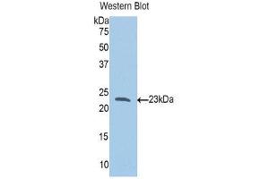 Western Blotting (WB) image for anti-Slit Homolog 1 (SLIT1) (AA 647-835) antibody (ABIN3204490) (SLIT1 Antikörper  (AA 647-835))