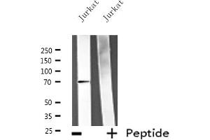 Western blot analysis of extracts from Jurkat cells, using ATG16L1 antibody. (ATG16L1 Antikörper  (C-Term))