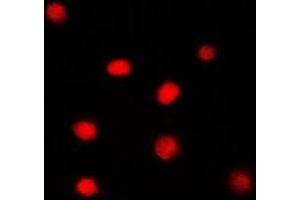 Immunofluorescent analysis of Glucocorticoid Receptor staining in PC12 cells. (Glucocorticoid Receptor Antikörper)