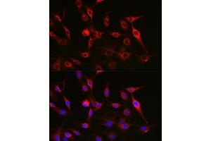 Immunofluorescence analysis of C6 cells using FAK Rabbit pAb (ABIN3022950, ABIN3022951, ABIN3022952 and ABIN6219313) at dilution of 1:100 (40x lens). (FAK Antikörper)