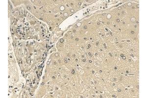 ABIN6265727 and ABIN6273334 at 1/100 staining human normal liver tissue by IHC-P. (TRIM14 Antikörper  (C-Term))