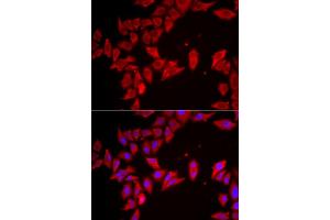 Immunofluorescence analysis of HeLa cells using SLC35A2 antibody (ABIN5974358). (SLC35A2 Antikörper)