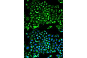 Immunofluorescence analysis of HeLa cells using DNM1L antibody (ABIN5971410). (Dynamin 1-Like Antikörper)