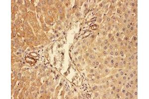 IHC-P: C5a antibody testing of rat liver tissue