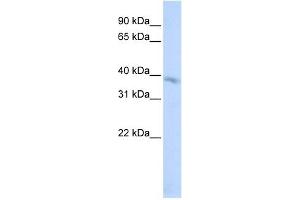 TMEM82 antibody used at 1 ug/ml to detect target protein. (TMEM82 Antikörper  (N-Term))