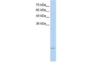 WB Suggested Anti-UBE2I Antibody Titration:  2. (UBE2I Antikörper  (N-Term))