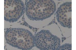Immunohistochemistry (IHC) image for anti-Keratin 15 (KRT15) (AA 94-402) antibody (ABIN1173001)