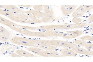 Detection of TNFb in Human Cardiac Muscle Tissue using Monoclonal Antibody to Tumor Necrosis Factor Beta (TNFb) (LTA Antikörper  (AA 36-205))