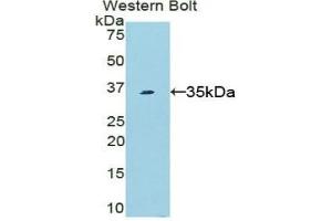 Western Blotting (WB) image for anti-Signal Transducer and Activator of Transcription 6, Interleukin-4 Induced (STAT6) (AA 557-841) antibody (ABIN7439333)