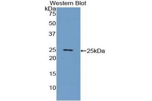 Detection of Recombinant CRP, Porcine using Polyclonal Antibody to C Reactive Protein (CRP) (CRP Antikörper  (AA 20-222))