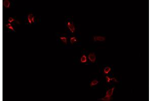 ABIN6269209 staining PC-3 cells by IF/ICC. (NOS1 Antikörper  (Internal Region))