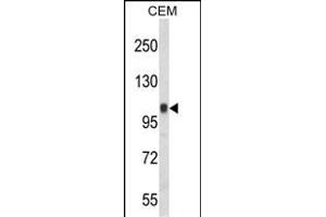 Western blot analysis of ITGB3 Antibody (C-term) (ABIN652616 and ABIN2842411) in CEM cell line lysates (35 μg/lane). (Integrin beta 3 Antikörper  (C-Term))