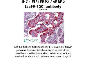 Image no. 1 for anti-Eukaryotic Translation Initiation Factor 4E Binding Protein 2 (EIF4EBP2) (AA 99-120) antibody (ABIN1733956) (eIF4EBP2 Antikörper  (AA 99-120))