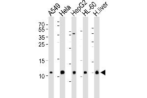 Western Blotting (WB) image for anti-Cytochrome C Oxidase Subunit VIb Polypeptide 1 (Ubiquitous) (COX6B1) (AA 8-22), (N-Term) antibody (ABIN6243632)