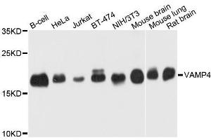 Western blot analysis of extracts of various cell lines, using VAMP4 antibody. (VAMP4 Antikörper  (AA 1-115))
