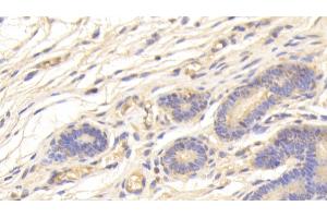Detection of SPINK5 in Human Uterus Tissue using Polyclonal Antibody to Serine Peptidase Inhibitor Kazal Type 5 (SPINK5) (SPINK5 Antikörper  (AA 699-976))