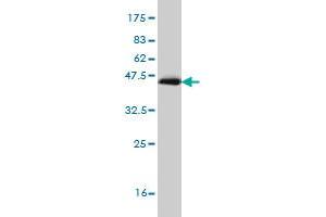 Western Blot detection against Immunogen (35. (RORB Antikörper  (AA 136-224))