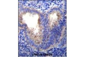 Immunohistochemistry (Paraffin-embedded Sections) (IHC (p)) image for anti-Eukaryotic Translation Initiation Factor 5A-Like 1 (EIF5AL1) (AA 94-122), (C-Term) antibody (ABIN655925)