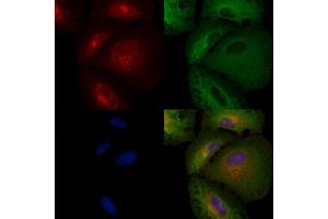 ABIN6257061 and ABIN6274183 staining  cells by IF/ICC. (CKMT2 Antikörper  (Internal Region))