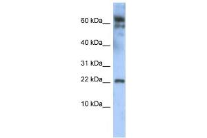 Western Blotting (WB) image for anti-Leucine Zipper, Down-Regulated in Cancer 1 (LDOC1) antibody (ABIN2458354) (LDOC1 Antikörper)