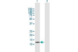 Western Blot analysis of DAAM2 expression in transfected 293T cell line by DAAM2 MaxPab polyclonal antibody. (DAAM2 Antikörper  (AA 1-132))