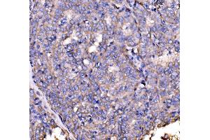 IHC analysis of Drebrin/DBN1 using anti-Drebrin/DBN1 antibody (ABIN7602638).