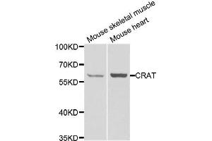 Western blot analysis of extracts of various cell lines, using CRAT antibody. (CRAT Antikörper)