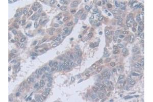 Immunohistochemistry (IHC) image for anti-Calpain, Small Subunit 1 (CAPNS1) (AA 1-268) antibody (ABIN7441262)