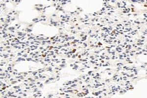 Immunohistochemistry analysis of paraffin-embedded mouse lung using,Factor XIIIa (ABIN7073528) at dilution of 1: 2400 (F13A1 Antikörper)