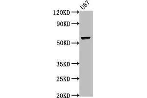 Western Blot Positive WB detected in: U87 whole cell lysate All lanes: PRAMEF17 antibody at 1:2000 Secondary Goat polyclonal to rabbit IgG at 1/50000 dilution Predicted band size: 55 kDa Observed band size: 55 kDa (PRAMEF17 Antikörper  (AA 69-259))
