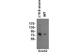 Image no. 1 for anti-Chaperone Protein DnaK (DNAK2) antibody (ABIN334577) (DNAK2 Antikörper)