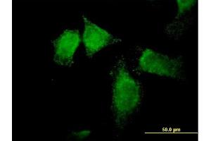 Immunofluorescence of purified MaxPab antibody to SNX13 on HeLa cell.