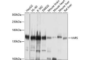 Western blot analysis of extracts of various cell lines, using VARS antibody (ABIN1683239, ABIN3018665, ABIN3018666 and ABIN6220533) at 1:1000 dilution. (VARS Antikörper  (AA 1-280))