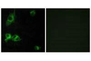 Immunofluorescence analysis of COS-7 cells, using LAMA1 antibody. (Laminin alpha 1 Antikörper)