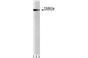 Western blot analysis of p150 [Glued] on a human endothelial cell lysate. (Dynactin 1 Antikörper  (AA 3-202))
