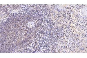 Immunohistochemistry (IHC) image for anti-Superoxide Dismutase 3, Extracellular (SOD3) (AA 19-240) antibody (ABIN7425701)